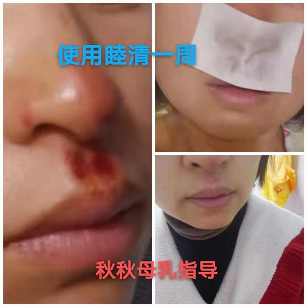 �����澏���N���Æ������M(f��i)�߿ڱ���������(sh��)���a(ch��n)ƷȦ�۟o(w��)��(sh��)